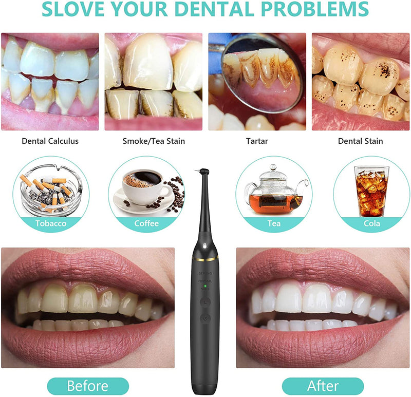 Electric Dental Calculus Remover