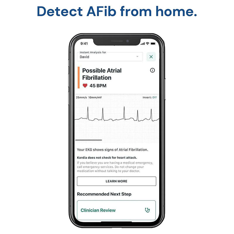 KardiaMobile ECG monitor displaying connection to smartphone app