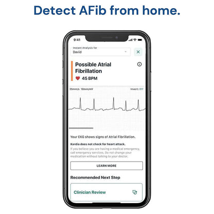 KardiaMobile ECG monitor displaying connection to smartphone app