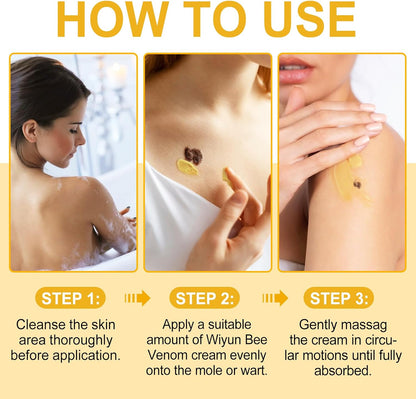 Bee Venom Moles and Warts Removal Cream