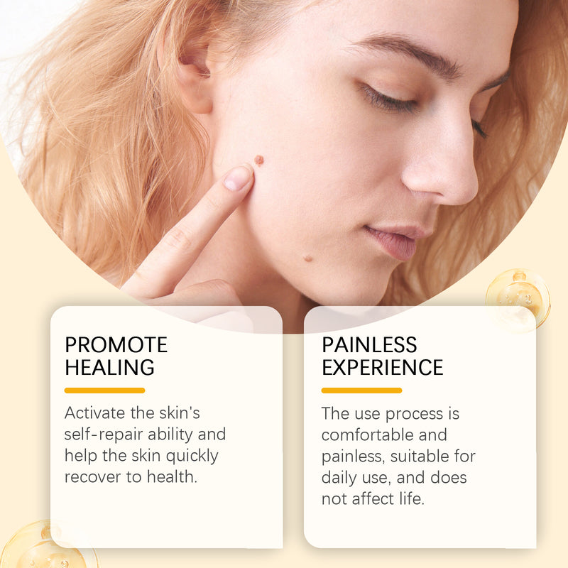 Bee Venom Moles and Warts Removal Cream