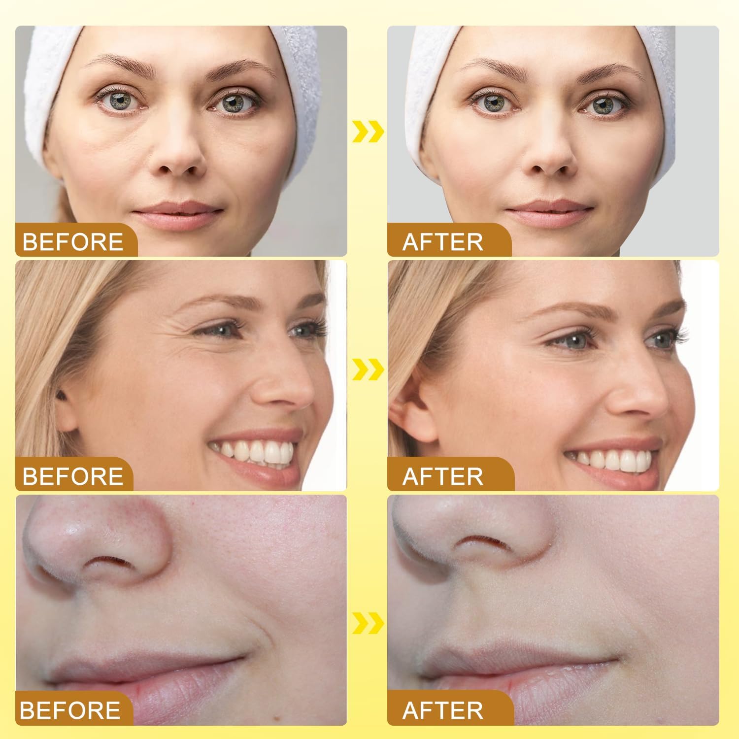Bee Venom Wrinkle Removal Cream showing smooth cream consistency