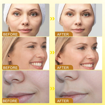 Bee Venom Wrinkle Removal Cream showing smooth cream consistency