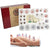 Massage vacuum cupping set showing all 24 pieces in kit