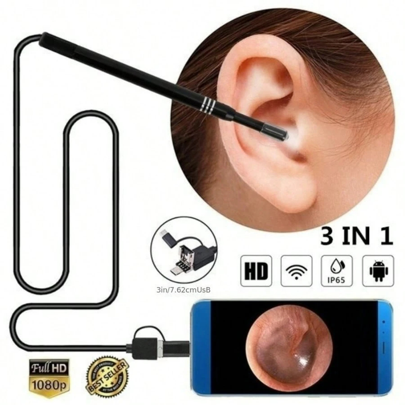 Endoscope Camera For Ear Cleaner Otoscope