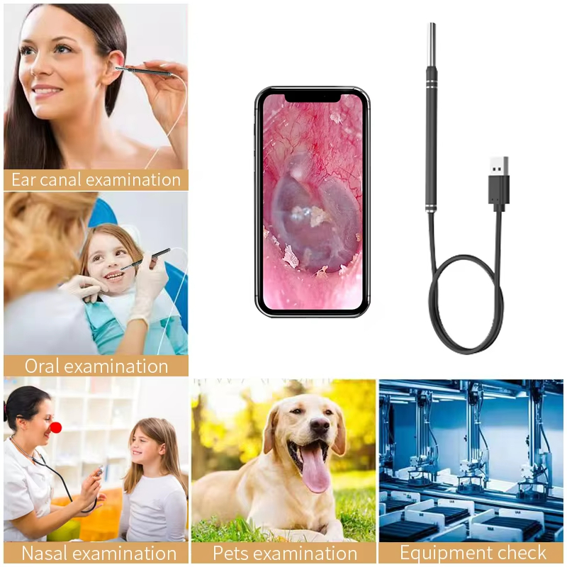 Endoscope Camera For Ear Cleaner Otoscope