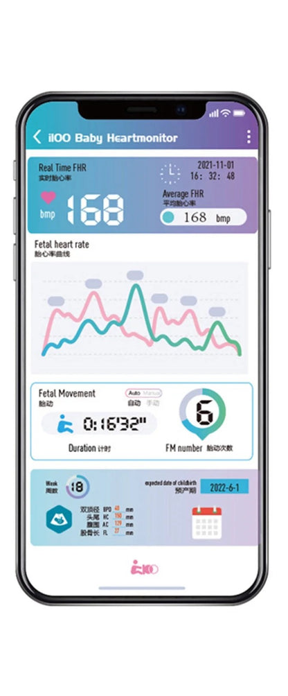 Fetal Doppler with battery compartment open showing AA batteries