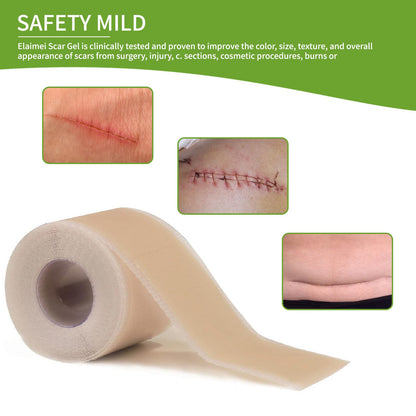Silicone Scar Sheets Silicone Scar Tape