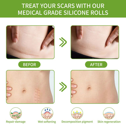 Silicone Scar Sheets Silicone Scar Tape