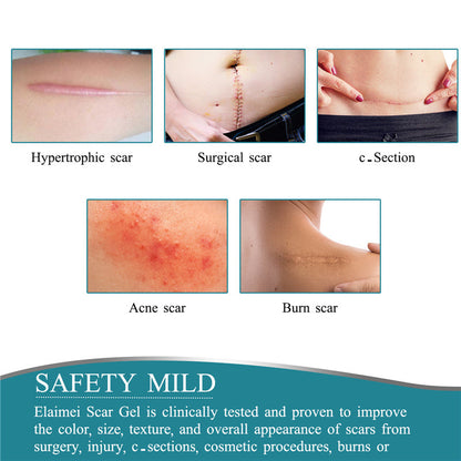 Silicone Scar Sheets Silicone Scar Tape