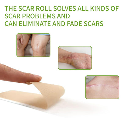 Silicone Scar Sheets Silicone Scar Tape
