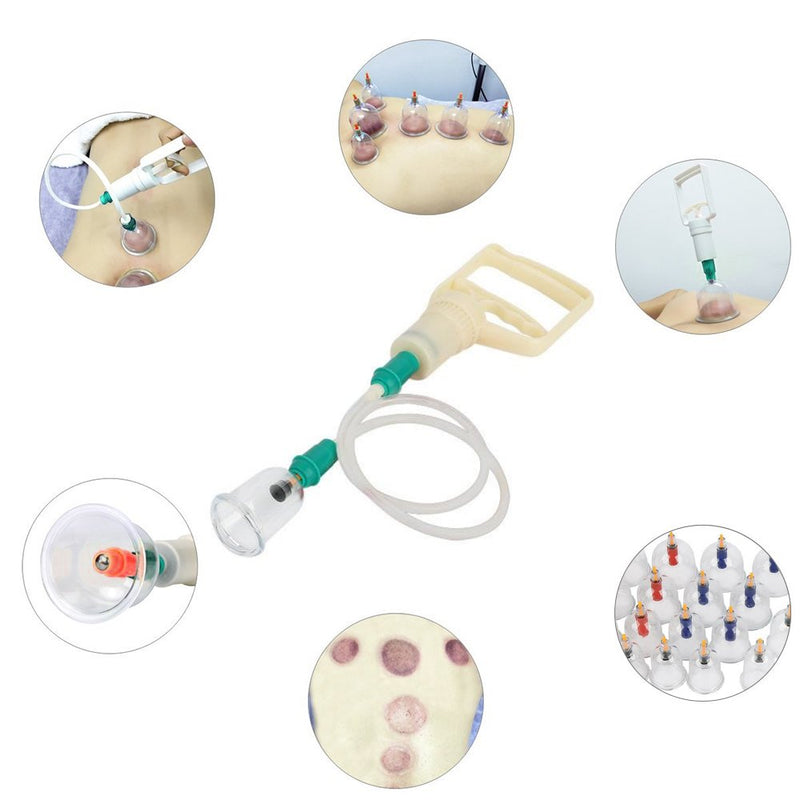 Massage Vacuum Cupping Set 24pcs